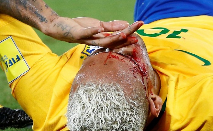 Gomitata a Neymar in Brasile-Bolivia