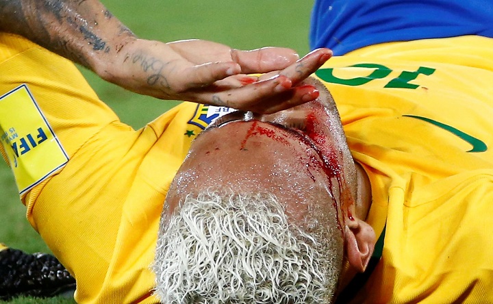 Gomitata a Neymar in Brasile-Bolivia